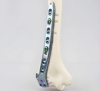 What are the side effects of titanium alloy leg implants?